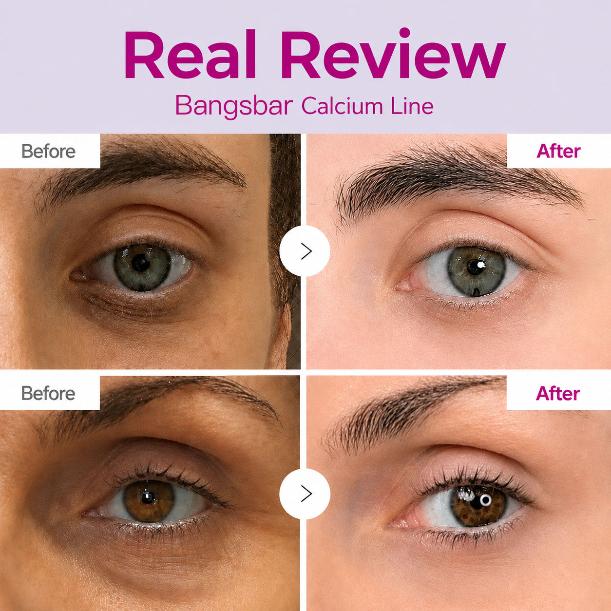🔥LAST DAY 50% OFF!!Bangsbar Korean Calcium Dark Spot Eye Cream
