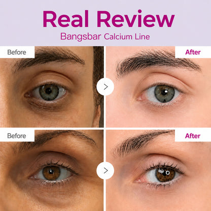 🔥LAST DAY 50% OFF!!Bangsbar Korean Calcium Dark Spot Eye Cream
