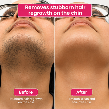 🔥LAST DAY 60% OFF  Bangsbar Hair Reduction Oil 60 ml – Permanent Hair Removal Oil