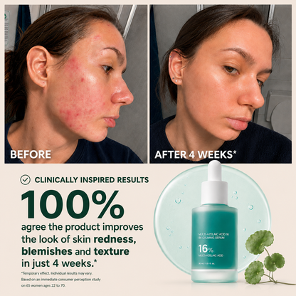 Bangsbar Anchoic Acid Soothing Serum