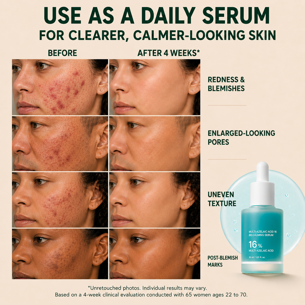 Bangsbar Anchoic Acid Soothing Serum