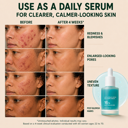 Bangsbar Anchoic Acid Soothing Serum