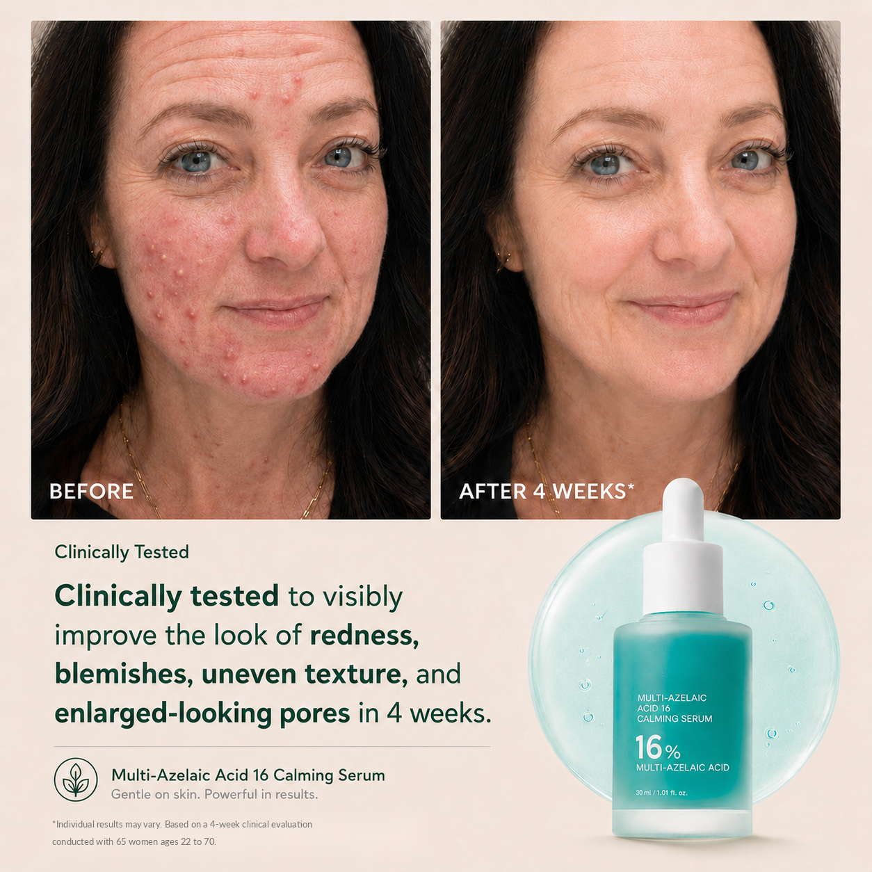 Bangsbar Anchoic Acid Soothing Serum