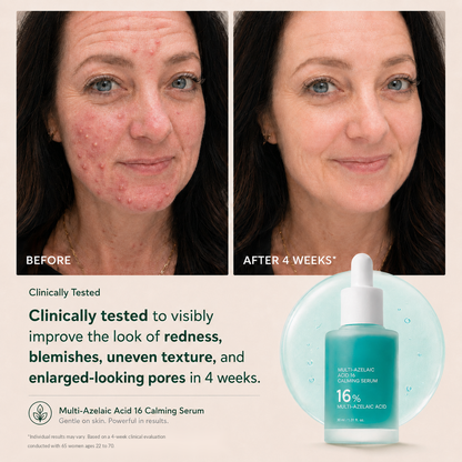 Bangsbar Anchoic Acid Soothing Serum